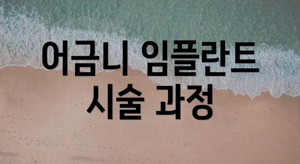어금니 임플란트 시술 과정